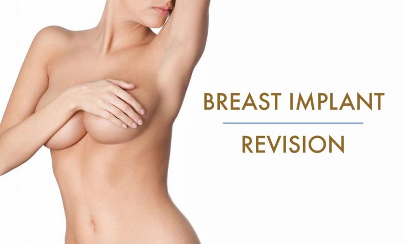 Breast Implant Revision in San Antonio