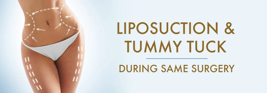 Can I Get Liposuction and Tummy Tuck At The Same Time? in Lawton Plastic Surgery San Antonio TX