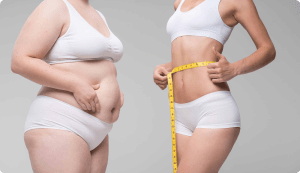 tumescent liposuction